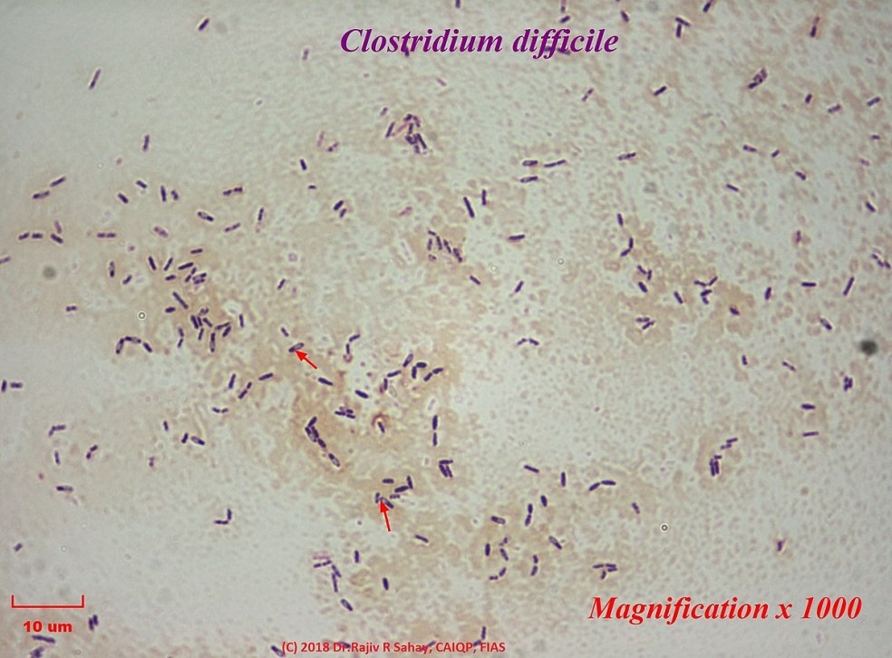 Clostridium difficile что это. Клостридии фото. Морфология клостридиум диффициле. Клостридия диффициле кал.